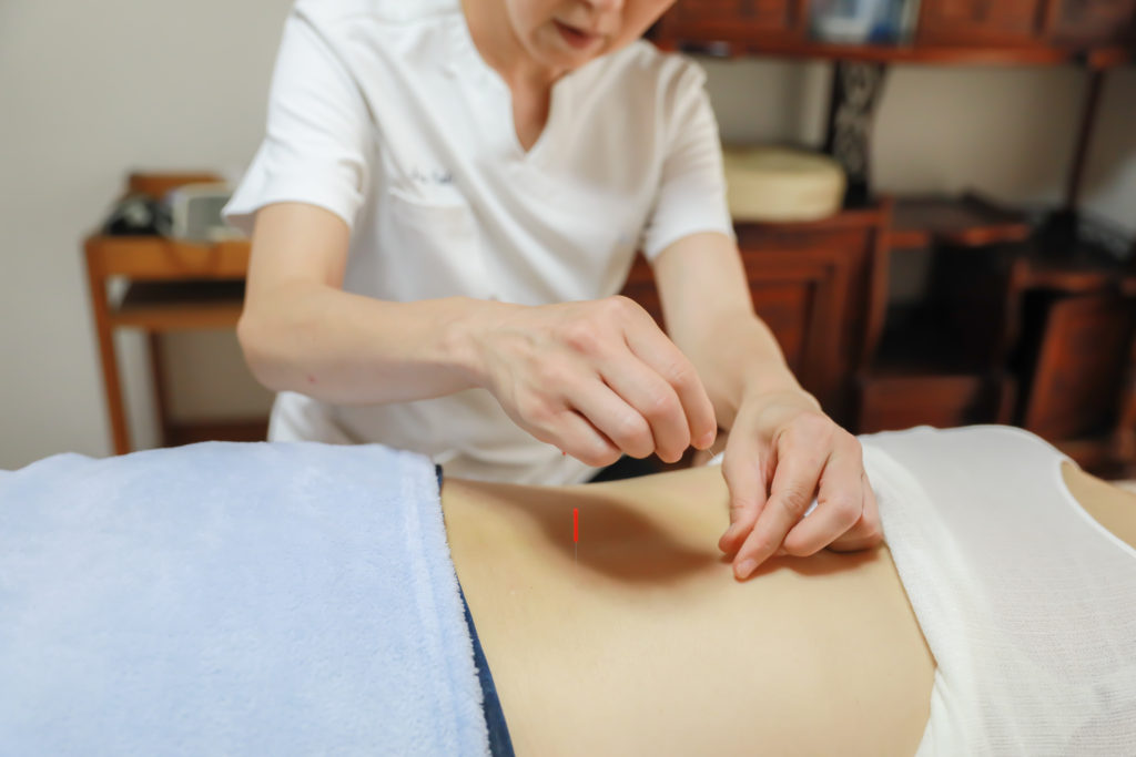 鍼灸治療について